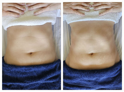 Daily Lymph Reset — The 11-Herb Formula That Reveals Your Real Shape